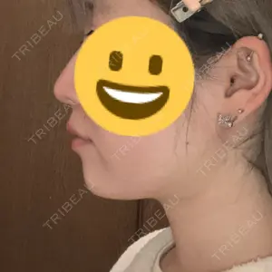 A CLINIC（エークリニック） A CLINIC（エークリニック） 池袋院口コミ