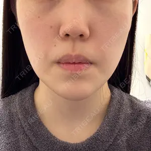 L‘amour clinic Tokyo【ラムールクリニック東京】の
