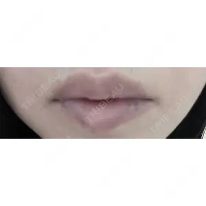 口コミ