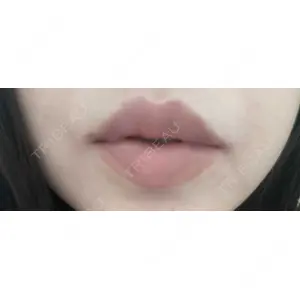 口コミ
