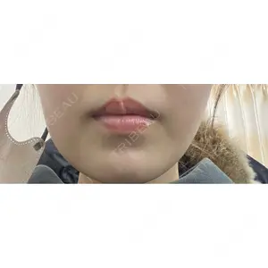 口コミ