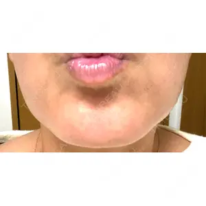 TCB東京中央美容外科 神戸院の