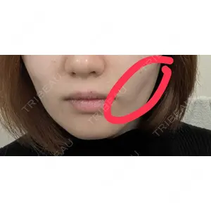 藤・ナチュレ美容クリニック 藤・ナチュレ美容クリニック 銀座院口コミ