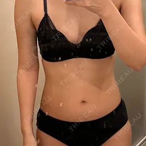 オアシス美容外科口コミ