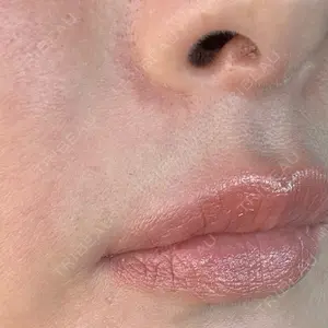 メディカルアルファクリニック口コミ