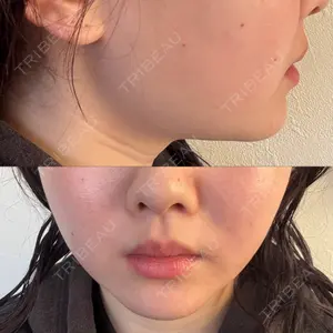 TCB東京中央美容外科 TCB東京中央美容外科 新宿東口院口コミ