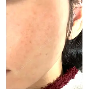 湘南美容クリニック 湘南美容クリニック 名古屋栄院口コミ