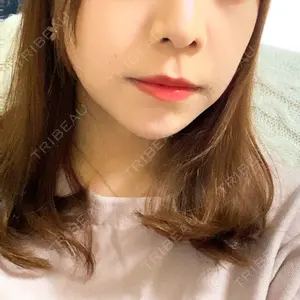 ルラ美容クリニック ルラ美容クリニック 池袋院口コミ