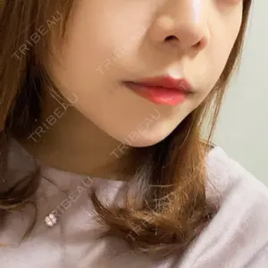 ルラ美容クリニック ルラ美容クリニック 池袋院口コミ