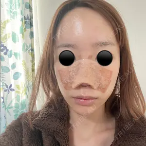 口コミ