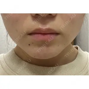 ルラ美容クリニック ルラ美容クリニック 町田院口コミ