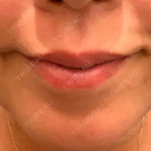 TCB東京中央美容外科 神戸院の