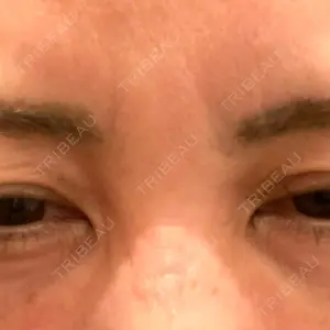 TCB東京中央美容外科 神戸院の