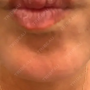 TCB東京中央美容外科 神戸院の