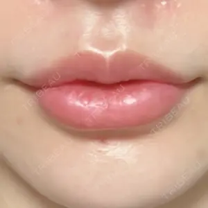 フィラークリニック フィラークリニック 福岡院口コミ