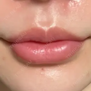 フィラークリニック フィラークリニック 福岡院口コミ