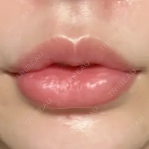 フィラークリニック フィラークリニック 福岡院口コミ