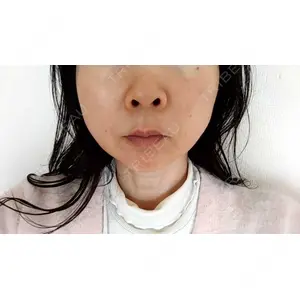 口コミ