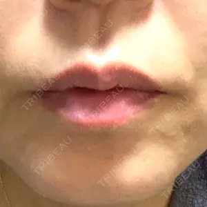 TCB東京中央美容外科 神戸院の