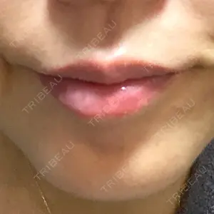 TCB東京中央美容外科 神戸院の