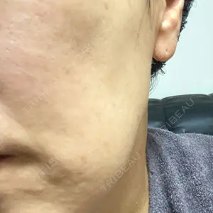 TCB東京中央美容外科 神戸院の