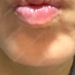 TCB東京中央美容外科 神戸院の