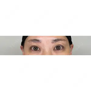 PRO CLINIC プロクリニック 銀座院口コミ