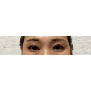 PRO CLINIC プロクリニック 銀座院口コミ