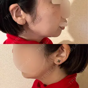 口コミ