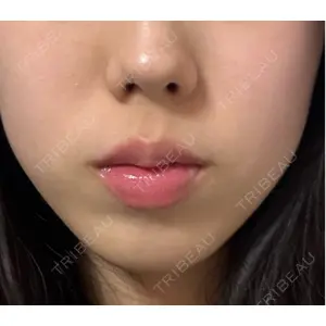 ルラ美容クリニック ルラ美容クリニック 池袋院口コミ