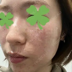 スマートスキンクリニック スマートスキンクリニック 神保町院口コミ