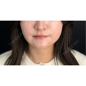 藤・ナチュレ美容クリニック 藤・ナチュレ美容クリニック 銀座院口コミ