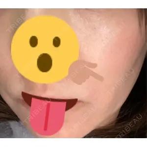椿クリニック 銀座TSUBAKIクリニック口コミ