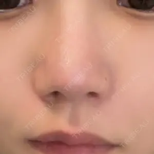 口コミ
