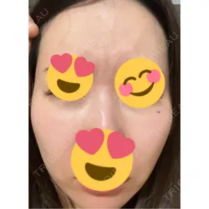 ミニマムスキンクリニック ミニマムスキンクリニック池袋口コミ