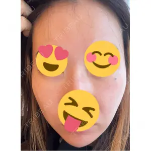 ミニマムスキンクリニック ミニマムスキンクリニック池袋口コミ