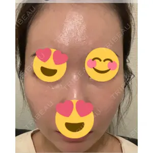 ミニマムスキンクリニック ミニマムスキンクリニック池袋口コミ