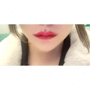 東京美容外科 東京美容外科 福岡院口コミ