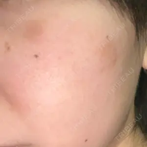 湘南美容クリニック 湘南美容クリニック 博多院口コミ