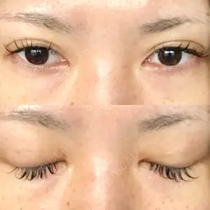 中央クリニック 大阪梅田中央クリニック美容外科口コミ