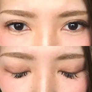 中央クリニック 大阪梅田中央クリニック美容外科口コミ