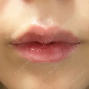 APスキンクリニック銀座口コミ