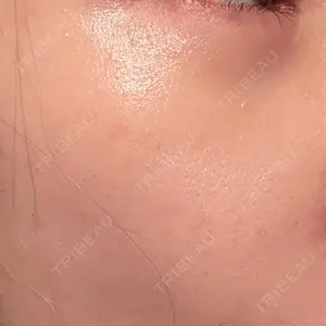 アスク美容クリニック銀座口コミ