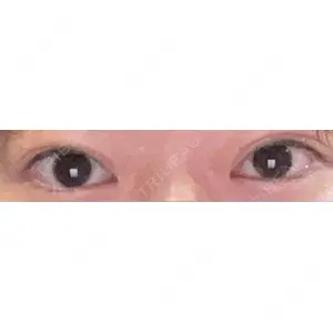 渋谷の森クリニック口コミ