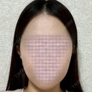 セギム美容整形外科口コミ