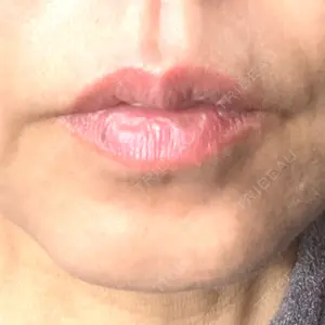 TCB東京中央美容外科 神戸院の