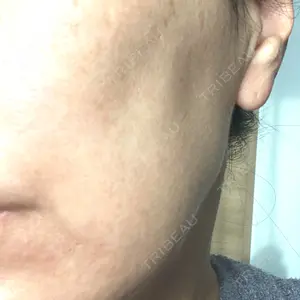 TCB東京中央美容外科 神戸院の