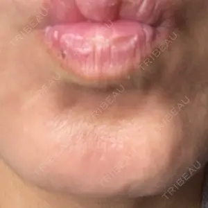 TCB東京中央美容外科 神戸院の