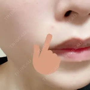 Fellez Clinic【フェルズクリニック】口コミ