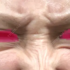 TCB東京中央美容外科 TCB東京中央美容外科 福岡天神院口コミ